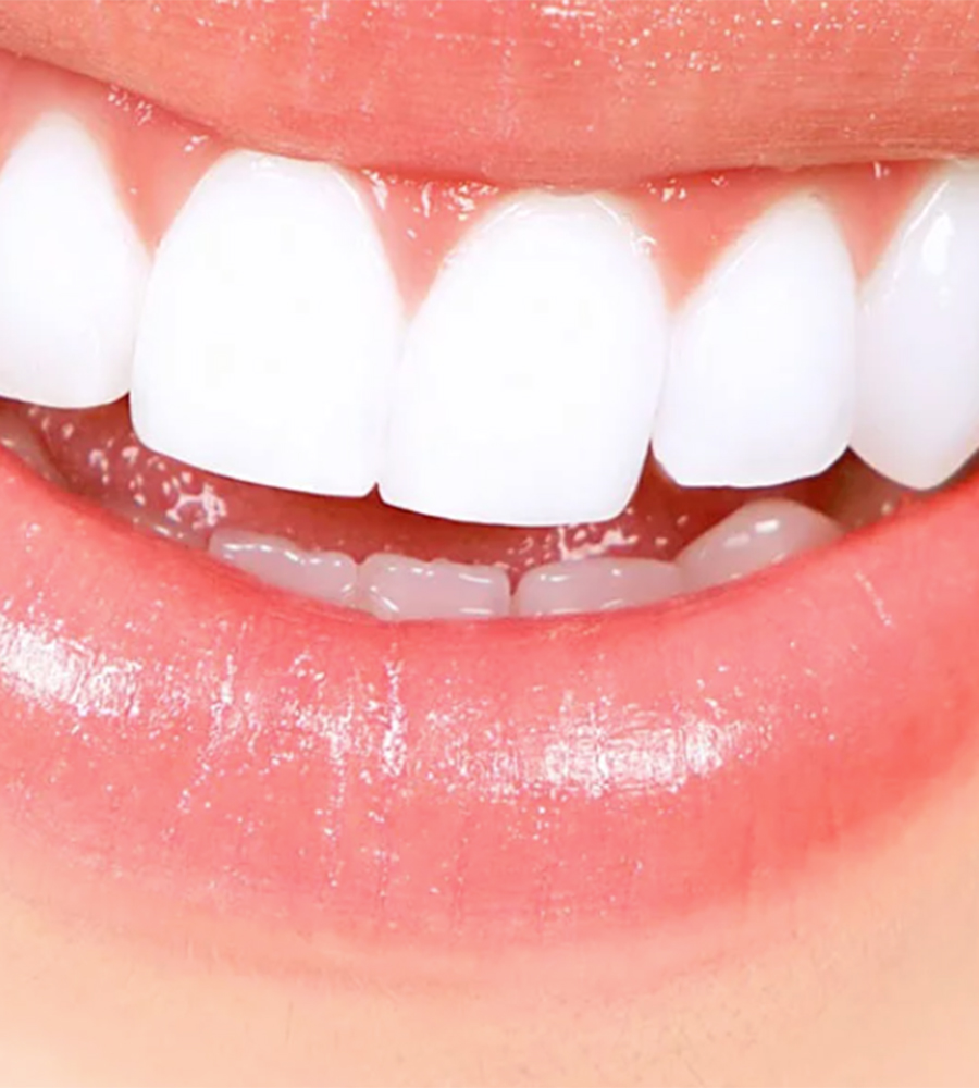 estetica-tratamiento-dentales-aviles-02